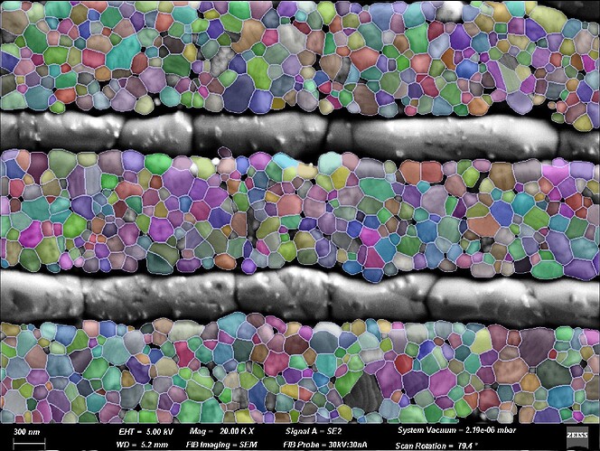 Murata-GrainSize-01-cellpose